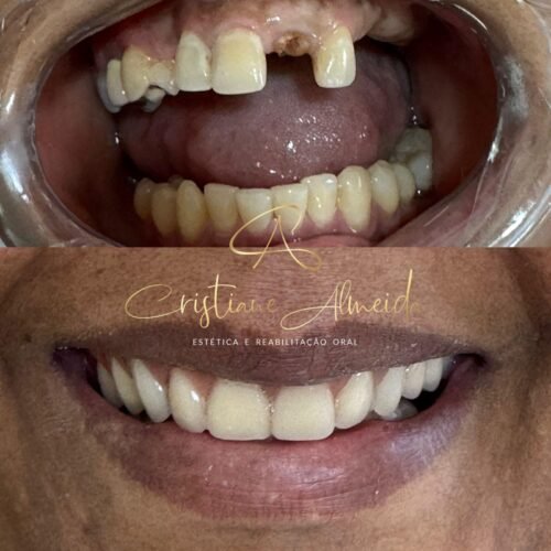 sorriso lindo e natural